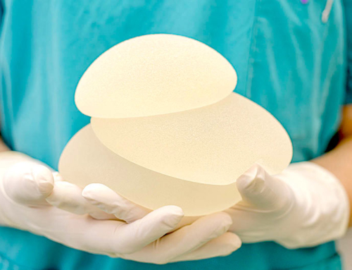 Breast Implant Illness – it’s real!